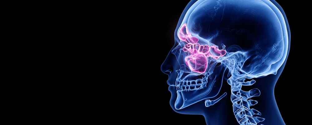 X-ray scan of sinus and skulll